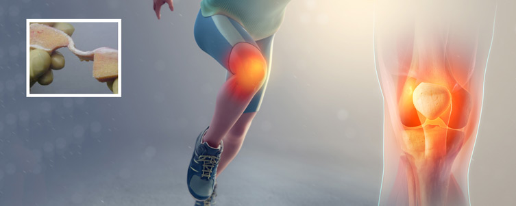 Tendon ve Bağ Ürünleri